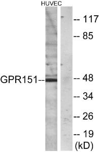 Western blot analysis of lysates from HUVEC cells using Anti-GPR151 Antibody. The right hand lane represents a negative control, where the Antibody is blocked by the immunising peptide