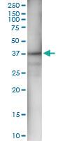 Anti-AKR1C4 Polyclonal Antibody Pair