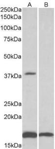 Anti-B3GAT1 Antibody (A83570) (0.1 µg/ml) staining of Human Frontal Cortex lysate (35 µg protein in RIPA buffer) with (B) and without (A) blocking with the immunizing peptide. Primary incubation was 1 hour. Detected by chemiluminescence