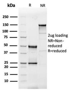 SDS-PAGE analysis of Anti-IL-3 Antibody [IL3/4005] under non-reduced and reduced conditions; showing intact IgG and intact heavy and light chains, respectively. SDS-PAGE analysis confirms the integrity and purity of the antibody.