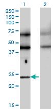 Anti-TFEC Mouse Monoclonal Antibody [clone: 4F11]