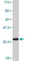 Anti-PRDM1 Mouse Monoclonal Antibody [clone: 2A3]