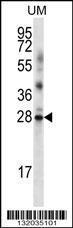 Anti-LRRN4CL Rabbit Polyclonal Antibody (HRP (Horseradish Peroxidase))