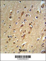 Anti-URGCP Rabbit Polyclonal Antibody (Biotin)