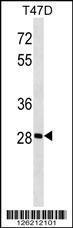 Anti-GK5 Rabbit Polyclonal Antibody (FITC (Fluorescein Isothiocyanate))