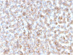 Immunohistochemical analysis of formalin-fixed, paraffin-embedded human liver using Anti-Apolipoprotein B Antibody [APOB/3300]