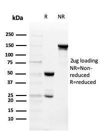 SDS-PAGE analysis of Anti-Intelectin 1 Antibody [ITLN1/4065] under non-reduced and reduced conditions; showing intact IgG and intact heavy and light chains, respectively. SDS-PAGE analysis confirms the integrity and purity of the Antibody