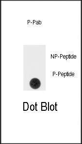 Anti-SPRY4 Rabbit Polyclonal Antibody (Biotin)