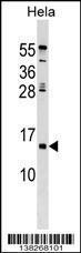 Anti-HHLA3 Rabbit Polyclonal Antibody (HRP (Horseradish Peroxidase))