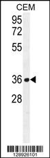 Anti-NUDT22 Rabbit Polyclonal Antibody [clone: 157CT16.6.6]