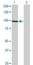 Anti-SRPK1 Mouse Monoclonal Antibody [clone: 3A11]