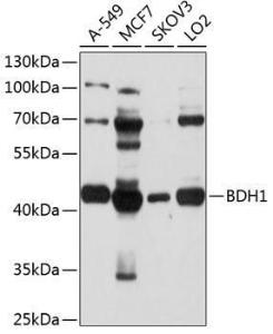 Anti-BDH1 antibody