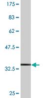 Anti-PRDM1 Mouse Monoclonal Antibody [clone: 1G9]