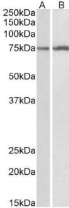 Anti-CYP2B6 Antibody (A85226) (0.1µg/ml) staining of HepG2 (A) and K562 (B) lysates (35µg protein in RIPA buffer). Primary incubation was 1 hour. Detected by chemiluminescence.