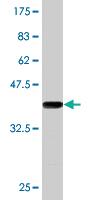 Anti-BARX2 Mouse Monoclonal Antibody [clone: 2B8]