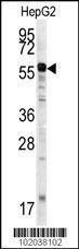 Anti-MMP20 Rabbit Polyclonal Antibody (APC (Allophycocyanin))