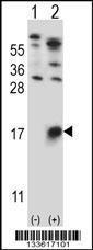 Anti-Glycophorin-B Rabbit Polyclonal Antibody (AP (Alkaline Phosphatase))