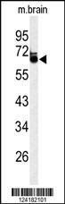 Anti-LRRTM1 Rabbit Polyclonal Antibody (FITC (Fluorescein Isothiocyanate))