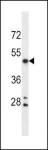 Anti-ALPL Rabbit Polyclonal Antibody