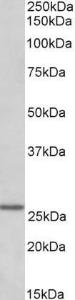 Anti-LAT2 antibody