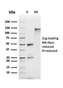 SDS-PAGE analysis of Anti-Apolipoprotein B Antibody [APOB/3300] under non-reduced and reduced conditions; showing intact IgG and intact heavy and light chains, respectively SDS-PAGE analysis confirms the integrity and purity of the antibody