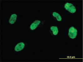 Anti-NHLH2 Mouse Monoclonal Antibody [clone: 1F4]