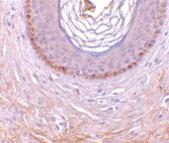 Anti-EDA2R Rabbit Polyclonal Antibody