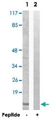 Anti-ATP5I Rabbit Polyclonal Antibody