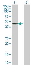 Anti-PHF7 Mouse Polyclonal Antibody