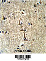 Anti-Glycerol-3-Phosphate Dehydrogenase Rabbit Polyclonal Antibody (FITC (Fluorescein))