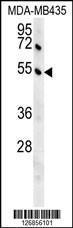 Anti-GKAP1 Rabbit Polyclonal Antibody (HRP (Horseradish Peroxidase))