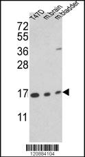 Anti-CPSF7 Rabbit Polyclonal Antibody