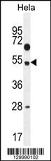 Anti-TSPYL6 Rabbit Polyclonal Antibody [clone: 165CT13.1.6]