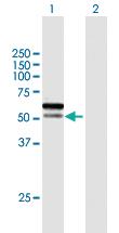 Anti-SPRTN Mouse Polyclonal Antibody