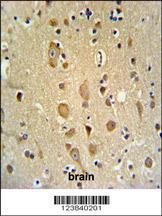 Anti-APITD1 Rabbit Polyclonal Antibody (HRP (Horseradish Peroxidase))