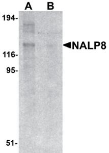 Anti-NLRP8 Rabbit Polyclonal Antibody