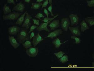 Anti-RUNX1 Mouse Monoclonal Antibody [clone: 4E7]