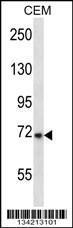 Anti-KCND3 Rabbit Polyclonal Antibody (HRP (Horseradish Peroxidase))