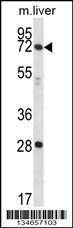 Anti-PAK3 Rabbit Polyclonal Antibody