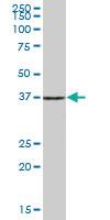 Anti-PHF7 Mouse Polyclonal Antibody