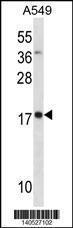 Anti-MYL4 Rabbit Polyclonal Antibody (AP (Alkaline Phosphatase))