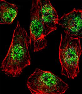 Anti-RHOXF2B Rabbit Polyclonal Antibody (AP (Alkaline Phosphatase))