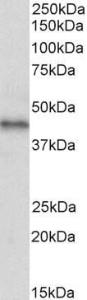 Anti-ACKR3 Antibody (A85228) (2µg/ml) staining of Human Breast cancer lysate (35µg protein in RIPA buffer). Primary incubation was 1 hour. Detected by chemiluminescence.