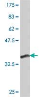 Anti-VCPIP1 Mouse Polyclonal Antibody