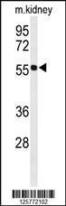 Anti-HIAT1 Rabbit Polyclonal Antibody (FITC (Fluorescein Isothiocyanate))