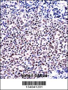 Anti-NFATC1 Rabbit Polyclonal Antibody (HRP (Horseradish Peroxidase))