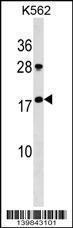 Anti-GKN1 Rabbit Polyclonal Antibody (FITC (Fluorescein Isothiocyanate))