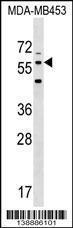 Anti-LRRTM2 Rabbit Polyclonal Antibody (PE (Phycoerythrin))