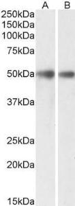 Anti-GDE1 Antibody (A85229) (0.3 µg/ml) staining of Mouse (A) and Rat (B) Brain lysates (35 µg protein in RIPA buffer). Primary incubation was 1 hour. Detected by chemilu minescence