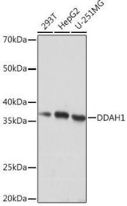 Western blot analysis of extracts of various cell lines, using Anti-DDAH1 Antibody [ARC1043] (A306259) at 1:1,000 dilution. The secondary antibody was Goat Anti-Rabbit IgG H&L Antibody (HRP) at 1:10,000 dilution.